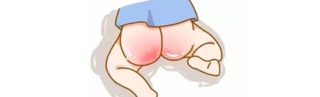 从原因、症状到预防、护理，宝宝红屁股最全的护理指南来了，新手爸妈收藏！