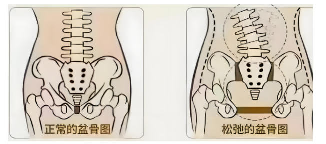 抓住产后骨盆修复的“黄金期”，用这4个方法找回“少女胯”！