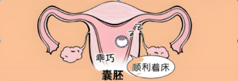 受精卵着床成功后，身体有感觉吗？这5个细微信号，备孕一定要知道！