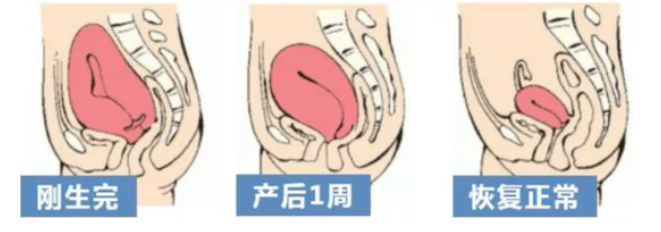 产后子宫恢复不好，身体会 “说话”！7 个修复要点帮你轻松应对！