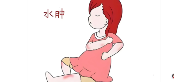 解密产后水肿的真相，3个原因 + 4 个消肿小技巧，轻松搞定！