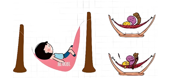产后减肥别瞎练！这 4 个动作最伤盆底肌，新手妈妈别踩坑！
