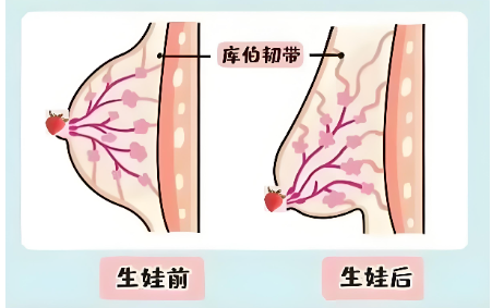 断奶后乳房下垂缩水自救指南:一套复位操+四步内衣法,亲测有效