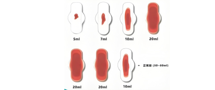 警惕月经量两类异常，这4种情况赶紧看医生！