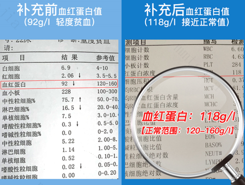 6个月的宝宝经常贫血，多是因为这4种原因，家长可以对症补铁