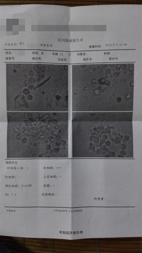 精子分析报告单怎么看