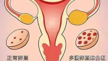 怎么才能提升怀孕几率