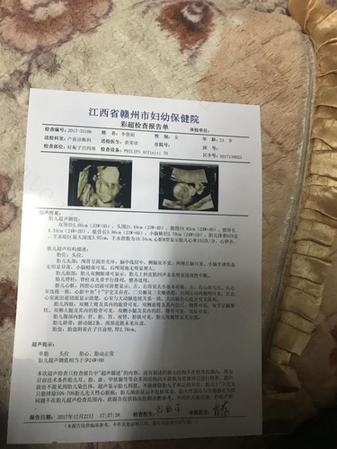 从彩超看生男生女,赶紧拿起彩超看看吧