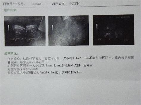 怀孕前三个月宝宝有哪些表现