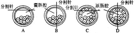 子宫形态异常影响怀孕吗