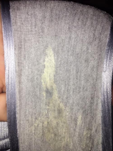 女性白带增多要紧吗