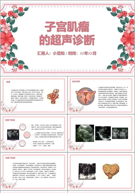 子宫肌瘤食谱大全窍门