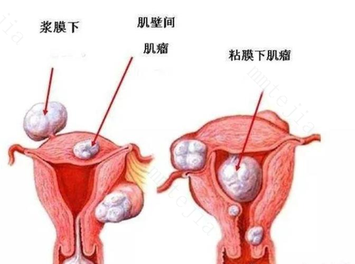 宫颈颜色发紫是宫寒吗 宫颈颜色发青发紫是什么原因