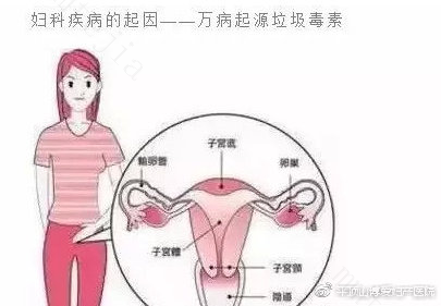 导致女性不孕的重大原因有哪些