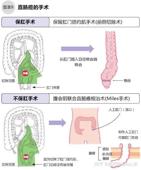 治疗睾丸癌的特效药