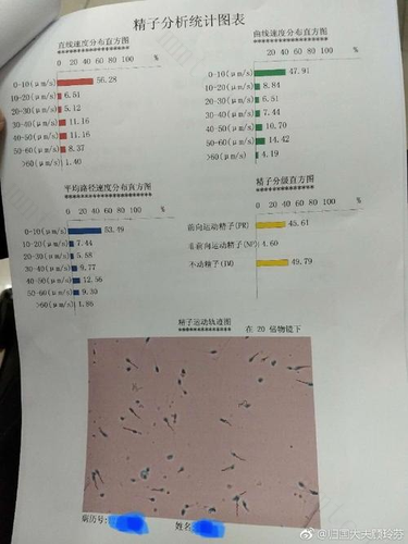 精子不液化表现有哪些