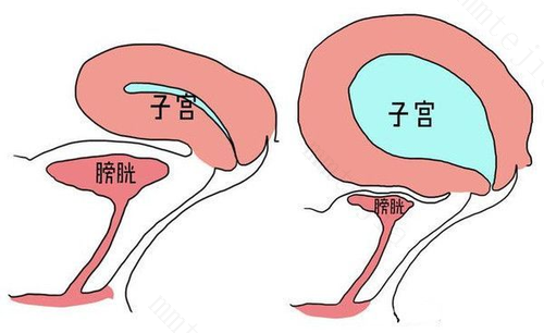 女性憋尿会导致不孕吗