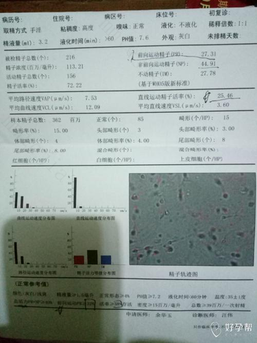 精子不液化可以生男孩吗