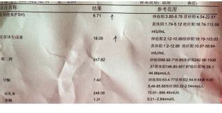 卵泡期黄体生成素偏高的原因