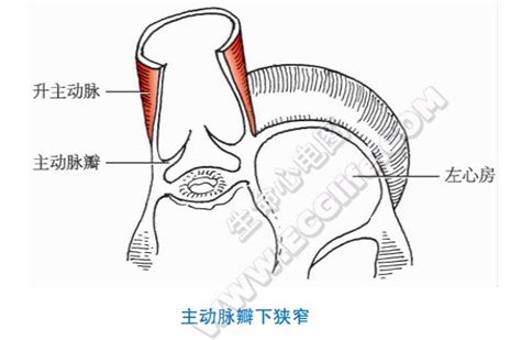 先天畸形是怎么造成的