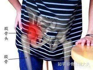 请问大腿根部疼痛是什么原因