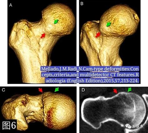 请问大腿根部疼痛是什么原因