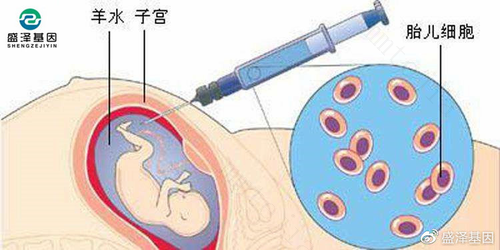 卵泡穿刺术要多少钱