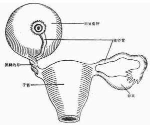 取卵后卵巢扭转怎么办