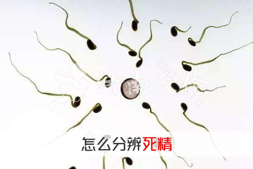 精子胶冻状是死精吗