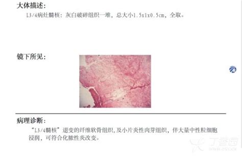 男性睾酮高的表现脱发