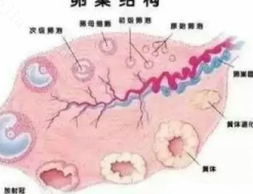 多囊卵巢综合症家族遗传吗