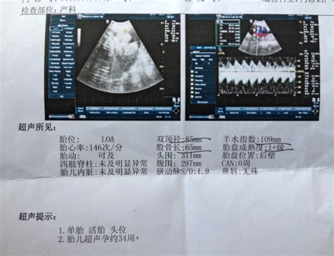 受孕成功之后还会排卵吗