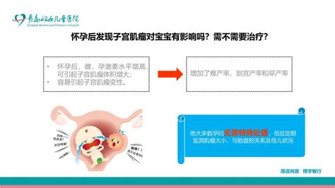 1公分的子宫肌瘤对怀孕有影响吗