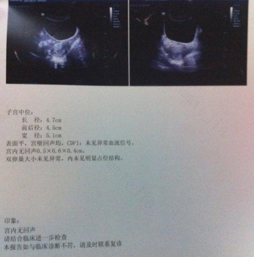 经历过一次胎停育，什么时候能再怀孕？