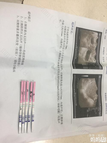 黄体破裂手术后多久可以怀孕 术后千万不要急着备孕