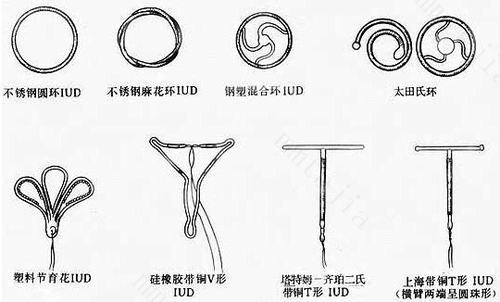 取环后多久才可以要孩子呢？