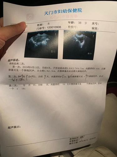 没有卵泡可以怀孕吗