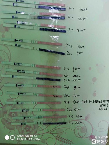 怎样知道卵子质量好不好 测一测便知道