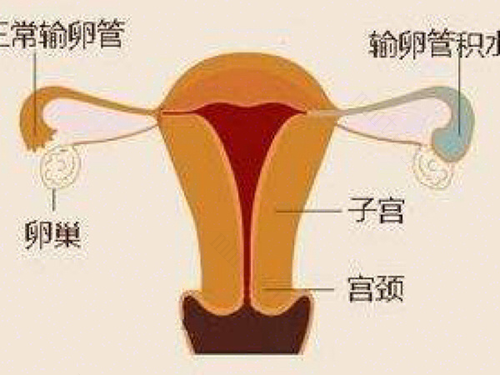 同房次数多了会引起盆腔充血吗