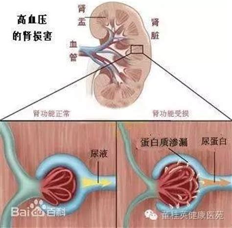 男人包茎会影响性功能吗