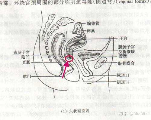 宫颈检查后同房了怎么办