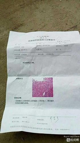 备孕期间，发现宫颈癌前病变该怎么办？