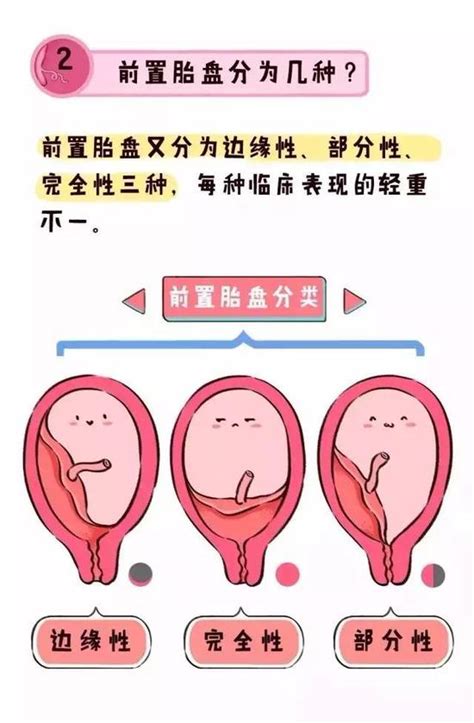 排卵期出血怎么治疗才会好