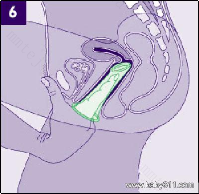 避孕套的正确用法