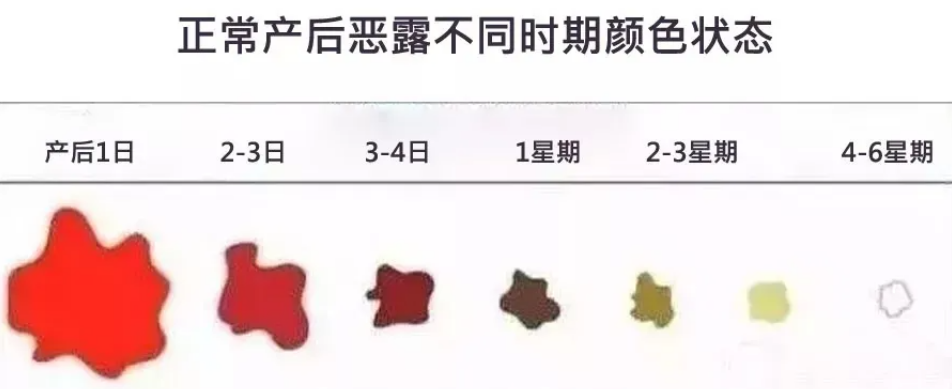 恶露不尽超过6周，排查这5个原因，除“恶”必尽，方法要用对！