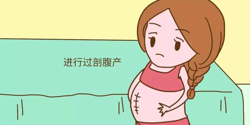 女性一生最多能做几次剖腹产？