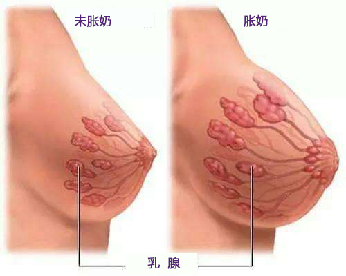 堵奶怎么办，你的乳腺还好吗？