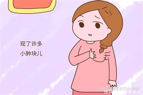 婚检能查出乳腺纤维瘤吗 婚检能检查出乳腺癌吗