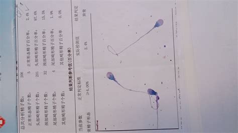 精子畸形率高怎么办，又该如何预防 如何降低精子畸形率