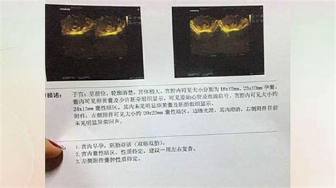 备孕真那么难吗 抓住3点成功怀孕 怀孕很难吗 为什么要备孕